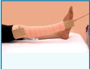 vrpl skin traction kit with crepe